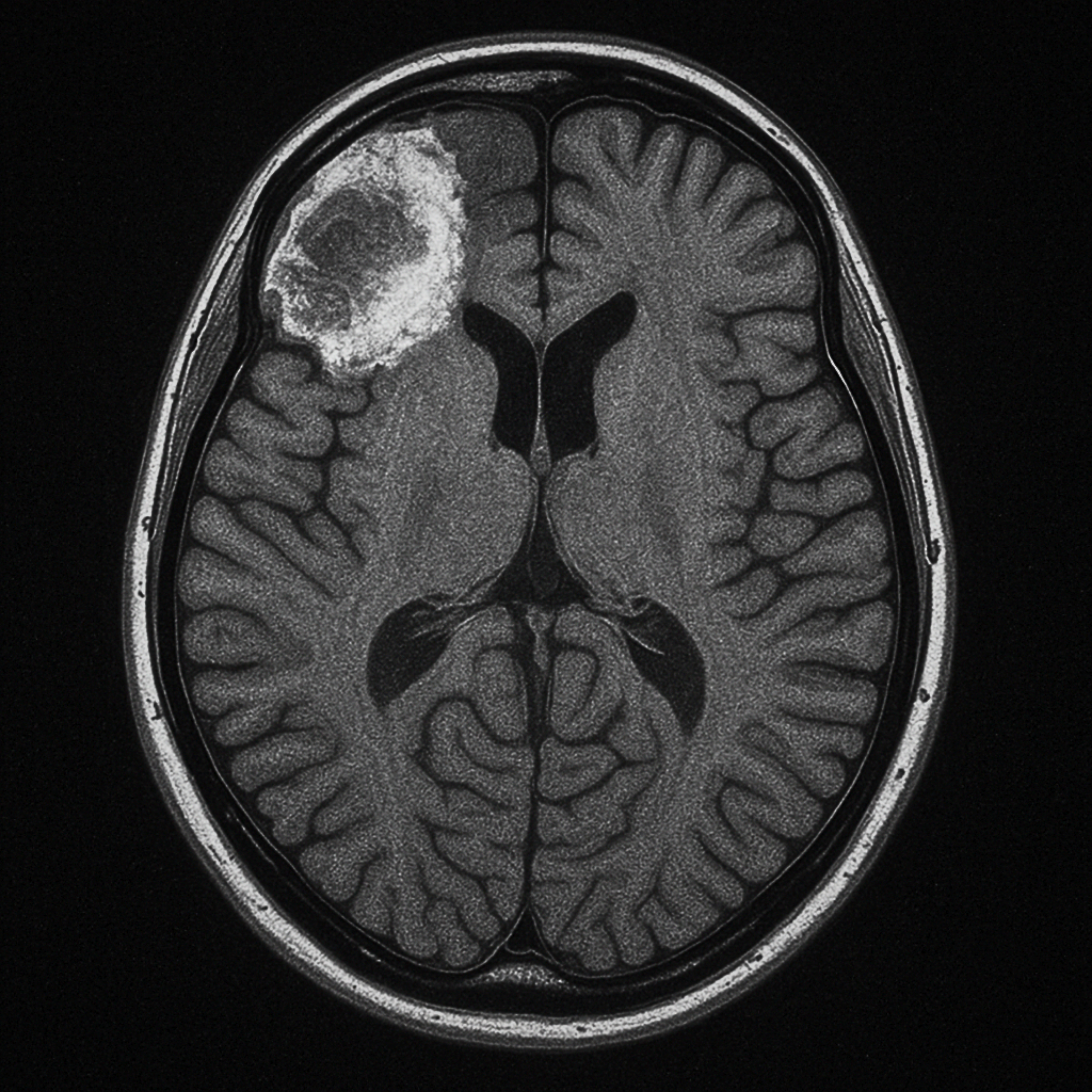 brain damage — EP, 2025